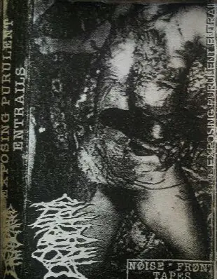 Exposing Purulent Entrails